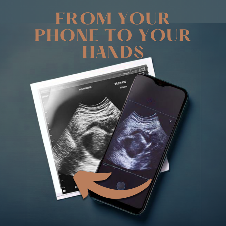 Ultrasound Printouts – From Digital to Authentic Strips