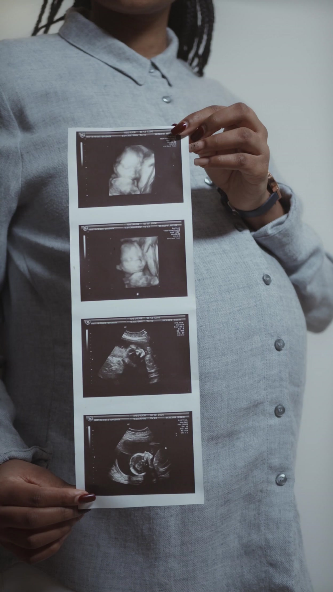 Traditional Ultrasound Print - Upload your Images