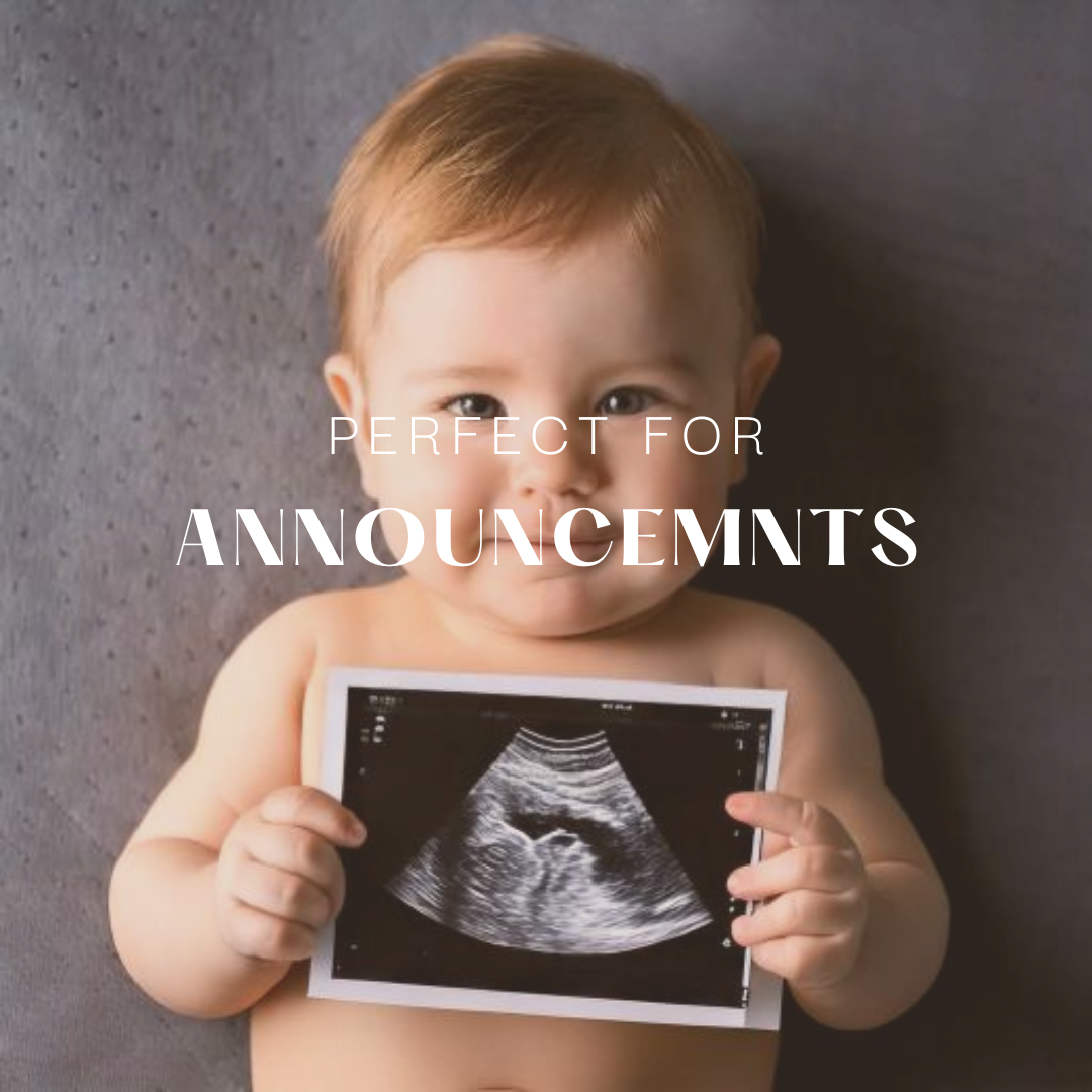 Cherish Every Moment with a Traditional Ultrasound Print