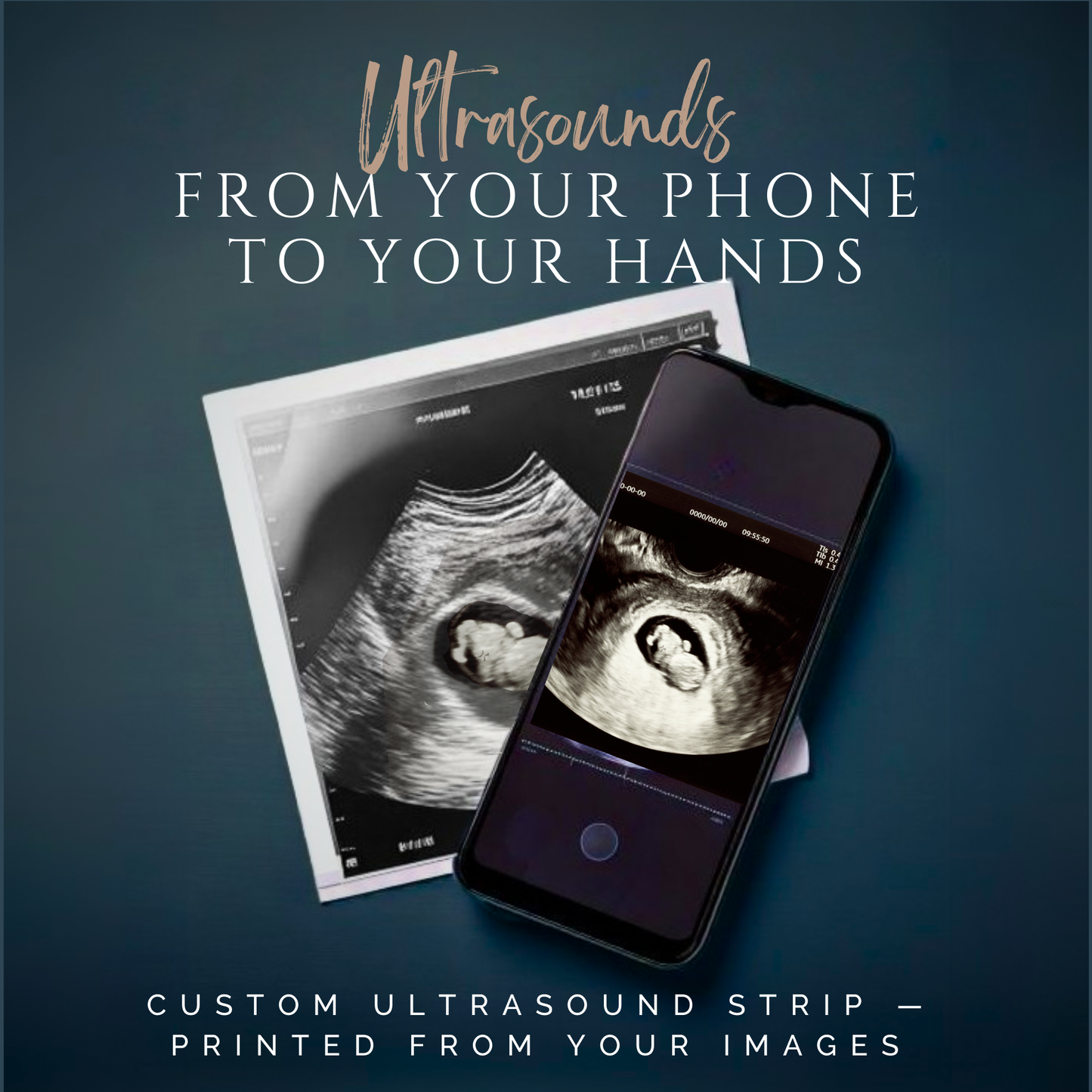 Traditional Ultrasound Print - Upload your Images