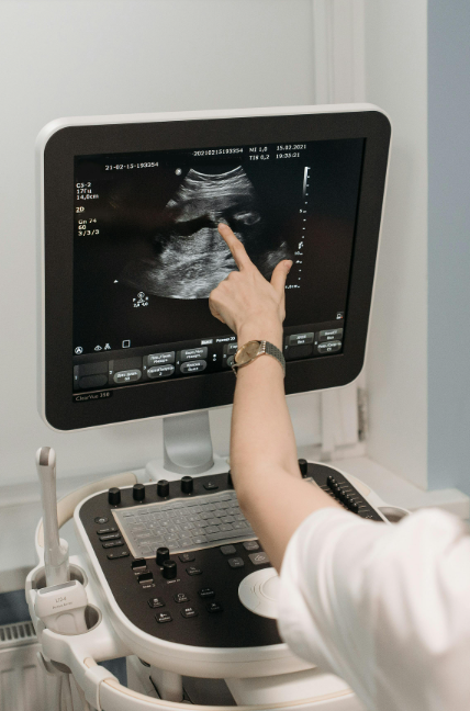 Heartbeat Peek